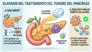 5 marzo 2026: BRCA e tumore del pancreas: cosa significa?